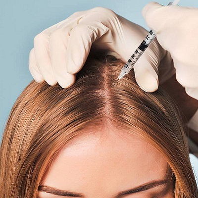Why People Choose Hair Fillers Treatment Over Other Options ?