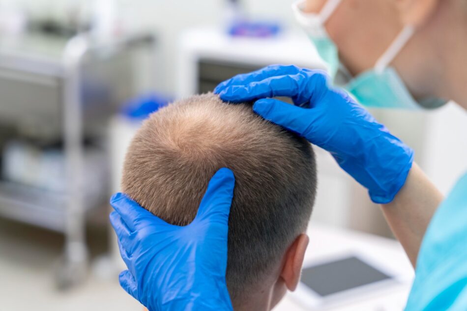 Fast Hair Transplant Solutions That Restore Your Hairline Safely