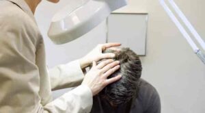 Common Questions to Ask Your Hair Specialist Doctor for Relief