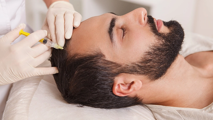 Best PRP Hair Treatment: How Many Sessions Are Needed?