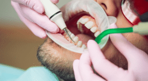 Who Needs Teeth Cleaning Cost Info for Planning?