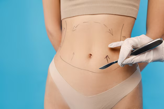 Tummy Tuck in Dubai