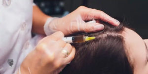 When Should You Start GFC Treatment For Hair In Dubai?