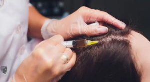 When Should You Start GFC Treatment For Hair In Dubai?