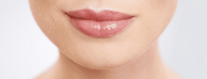 Pink Lips Laser Treatment Explained Safe Steps for Lasting Glow