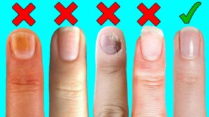 Simple Daily Habits to Keep Your Nails and Skin Healthy and Strong