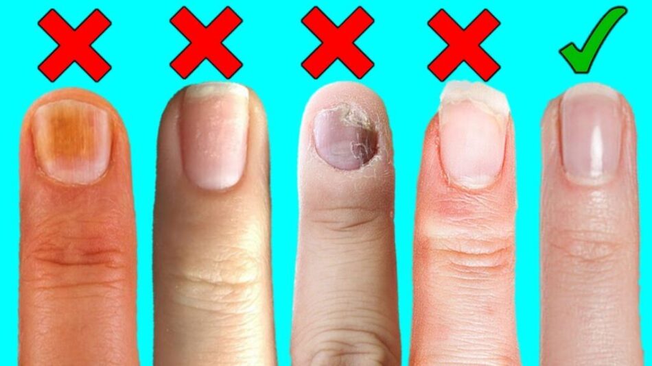 Simple Daily Habits to Keep Your Nails and Skin Healthy and Strong
