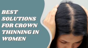 Best Solutions for Crown Thinning in Women: Why Hair Toppers Work