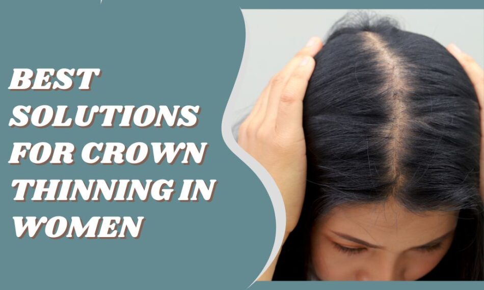 Best Solutions for Crown Thinning in Women: Why Hair Toppers Work