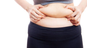 How Much Downtime Does Tummy Tuck Surgery Require?