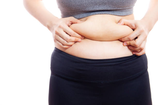 How Much Downtime Does Tummy Tuck Surgery Require?